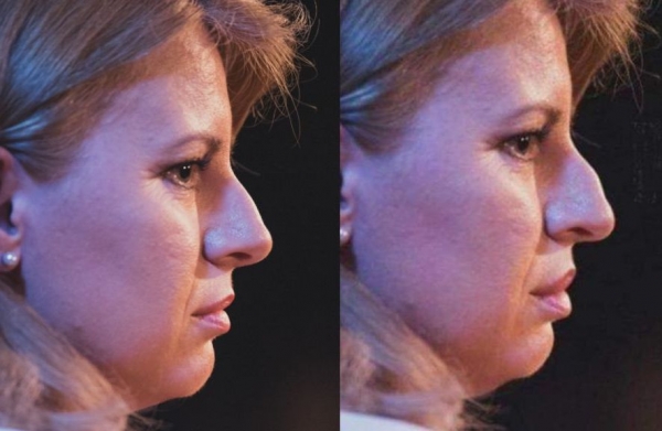 Foto: Denník N/upravená verzia v Zem a Vek