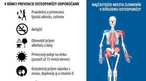 Ako si udržať zdrav&eacute; kosti bez osteropor&oacute;zy: Dodržujte t&yacute;chto 8 pravidiel