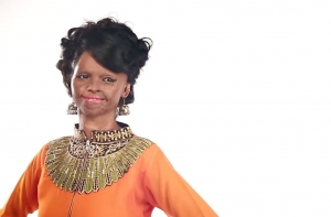 Indka, ktorej znetvorili tv&aacute;r kyselinou, je tv&aacute;rou kampane m&oacute;dnej značky