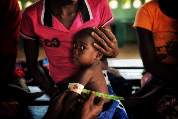 MAGNA ročne vylieči viac ako 10 tis&iacute;c podvyživen&yacute;ch det&iacute;